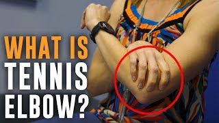 Injury Spotlight What is Tennis Elbow Stretches amp Exercises [upl. by Clancy]