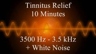 Tinnitus relief  10 minutes  3500 Hz  35 kHz  White Noise [upl. by Megan]