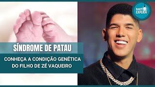 Síndrome de Patau Conheça a condição genética do filho do cantor Zé Vaqueiro  RedeTV Explica [upl. by Cloots]