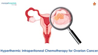 Hyperthermic Intraperitoneal Chemotherapy for Ovarian Cancer l Manipal Hospitals Bengaluru [upl. by Matty]