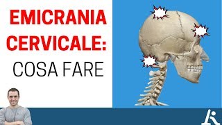 I problemi cervicali possono portare emicrania ecco cosa fare [upl. by Spillar823]