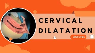 Cervical Dilatation [upl. by Dlared]