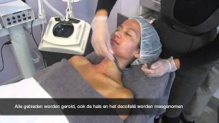 Micro Needling treatment [upl. by Stauffer]