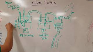 How Chest Tubes Work Tube Thoracostomies [upl. by Kila]