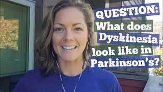 What does dyskinesia look like in Parkinson’s [upl. by Shellie]