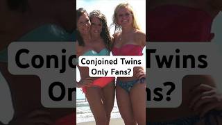 Conjoined Twins Abby amp Brittany Furious After Media Leak conjoinedtwins shorts [upl. by Akemor273]