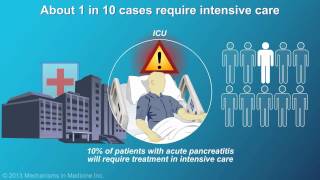 Management and Treatment of Acute Pancreatitis [upl. by Ilysa]