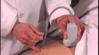 Ultrasound Guided Hip Injection SonoSite [upl. by Jelsma702]