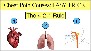 Causes of Chest Pain EASY TRICK to Never Miss an Emergency Must See [upl. by Yregerg]