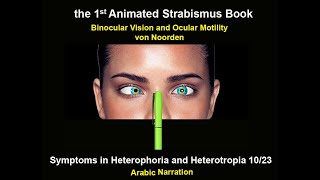 Symptoms in Heterophoria and Heterotropia and the Psychological Effects of Strabismus [upl. by Netti]