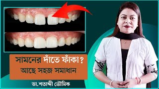 সামনের দাঁতে ফাঁকা  Gap Between Front teeth  Dr Shatabdi Bhowmik  Bangla [upl. by Ddart]