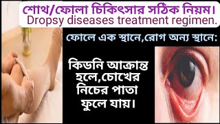 678 শোথফোলা চিকিৎসার সঠিক পদ্ধতি Dropsy diseases treatment regimen [upl. by Ramsdell]