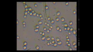 Cellule al microscopio Lievito di birra Saccharomyces Cerevisiae [upl. by Airotna]