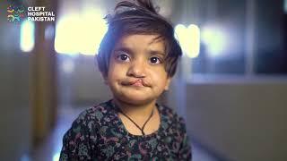 Importance of Speech Therapy for Cleft Patients  clefthospitalpakistan [upl. by Sylado857]