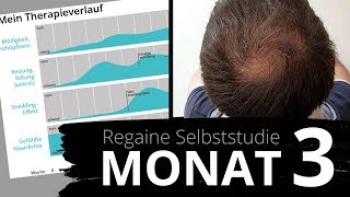 Regaine Monat 3  Der ultimative Erfahrungsbericht [upl. by Valerie]