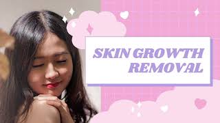 Remove Skin Growths  Subliminal to Get Rid of Unwanted Lumps and Bumps [upl. by Oca]