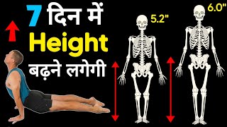 Height kaise badhaye  Height badhane ki dava  लंबाई कैसे बढ़ाएं Exercise [upl. by Ittocs82]