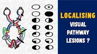 Visual Field Defects  Medical Tutorial [upl. by Oglesby195]