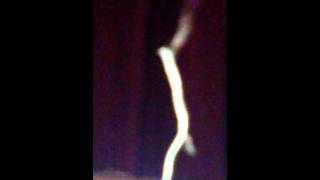 Morgellons moving fibers [upl. by Del654]