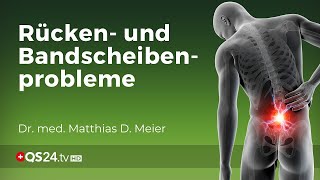 Schmerzen im Rücken Hilflose Medizin agiert nicht ursachenbezogen  Dr med M D Meier  QS24 [upl. by Sherrill]