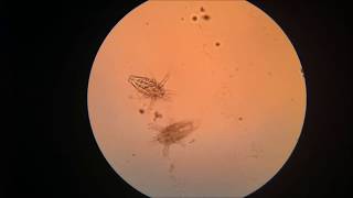 Zooplankton in the Microscope [upl. by Kramnhoj]