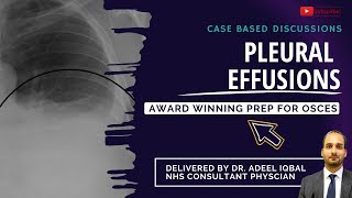 Pleural Effusion Cases  Respiratory  BEST OSCE Preparation for Medical Student Exams [upl. by Etz]