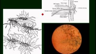 neuroophthalmology pt4 [upl. by Bathilda]