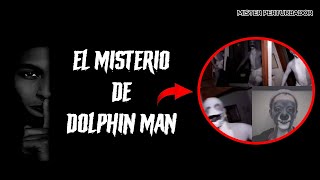 EL HOMBRE CON CARA DE DELFIN DOLPHIN MAN [upl. by Gal]