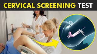 Pap Smear Pap Test  Early Detection for Cervical Cancer  Understanding the Procedure [upl. by Adah121]