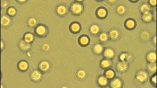 Lysis of erythrocytes in the hypotonic buffer [upl. by Steere482]