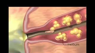 Do I have mites on my eyelids amp eyelashes Demodex Blepharitis can cause redness dryness itchiness [upl. by Dracir262]