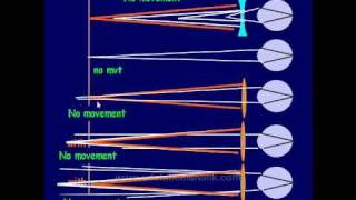 Optics  Retinoscopy Part One in Arabic [upl. by Aitrop105]