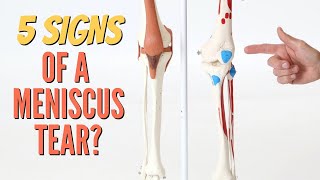 5 Signs Your Knee Pain is a Meniscus TearSelfTests Cartilage Updated [upl. by Kristopher241]