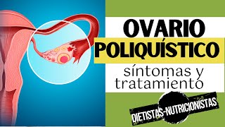 SÍNDROME DE OVARIO POLIQUÍSTICO o SOP  Síntomas y tratamiento [upl. by Thurlow]