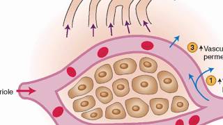 Mechanisms of edema development [upl. by Ramuk]