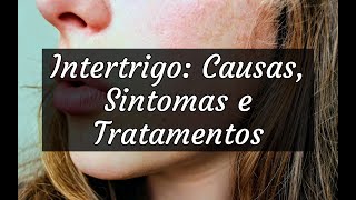 Intertrigo Causas Sintomas e Tratamentos [upl. by Lili]