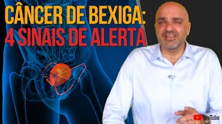 4 Sinais de Alerta e Fatores de Risco para CÂNCER DE BEXIGA [upl. by Hollinger]