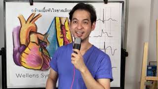 Wellens Syndrome กล้ามเนื้อหัวใจขาดเลือดที่มักอ่านผิด [upl. by Navanod]