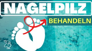 🚀NAGELPILZ NATÜRLICH BEHANDELN🚀 12 Hausmitel gegen Nagelpilz Nagelpilz Behandlung leicht gemacht [upl. by Sarah]