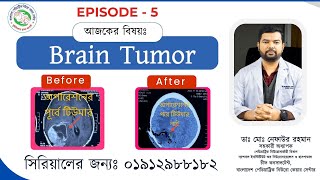 Before After Episode  5  Brain Tumor Surgery  Best Paediatric Neurosurgeon Nafaur in Bangladesh [upl. by Notluf759]