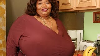 Woman With Biggest This In The World  Norma Stitz [upl. by Yerrot]