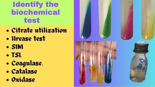 Biochemical Test  Bacterial Identification Technique Microbiology Practical Exam bacteriology [upl. by Adonis]