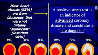 What Does Your Stress Test Really Mean  The Princeton Longevity Center [upl. by Nyrehtac]