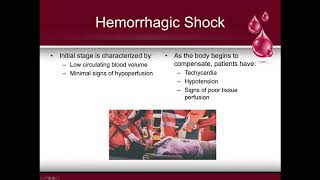 First aid  Shock and bleeding [upl. by Hollingsworth]