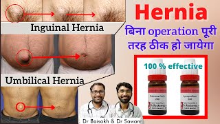 VIDEO How to Fix a Hiatal Hernia  drdavidwilliamscom [upl. by Ydnat]