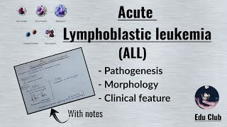 ALL Acute Lymphoblastic LeukemiaLymphoma  Disorders of White Cells  Lymphoid neoplasm Pathology [upl. by Torhert734]