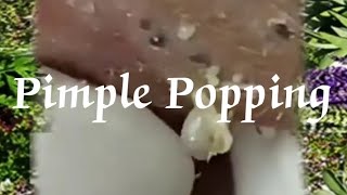 Pimple amp Blackheads Popping  11 [upl. by Brackett843]