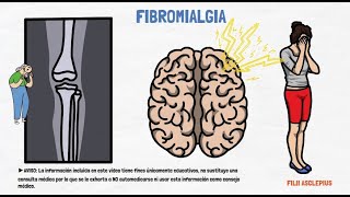 FIBROMIALGIA  QUÉ ES SIGNOS Y SÍNTOMAS Y TRATAMIENTO [upl. by Mussman]