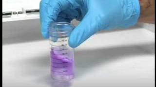 Chloride Test [upl. by Myrna]