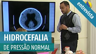 Qual o tratamento para hidrocefalia de pressão normal Quais os sintomas de hidrocefalia crônica [upl. by Durtschi]